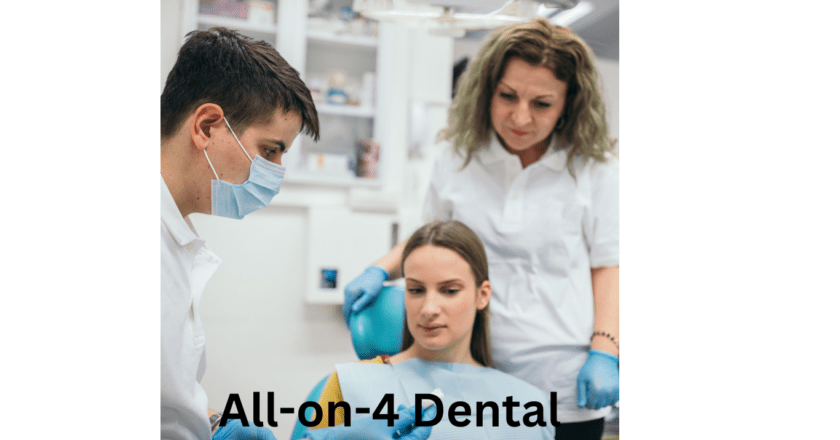 How to Clean All-on-4 Dental Implants?